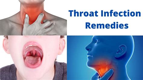 What Does The Throat Look Like