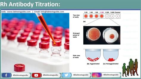 antibody screen test Archives - Lab Tests Guide