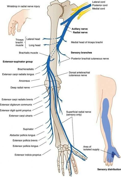 Radial never injury | Radial nerve, Nerve anatomy, Medical anatomy