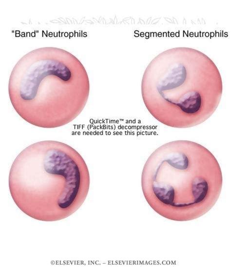 Band neutrophil or Staff Cell | Medical Laboratories