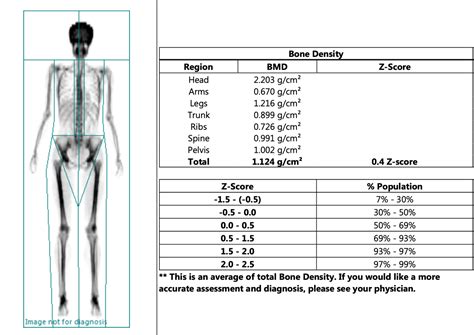 My experience with a DEXA Scan! What is it, and is it worth it? — Whole Body Health Physical ...