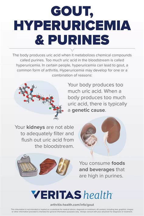 Gout, Hyperuricemia and Purines Infographic | Arthritis-health