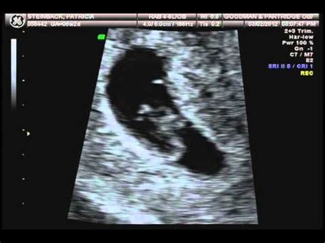 7 week ultrasound heartbeat - YouTube