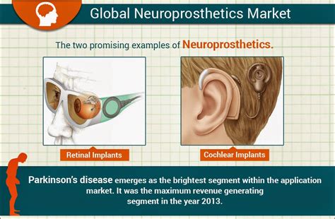 Allied Market Research: Parkinson’s disease emerges as the brightest ...