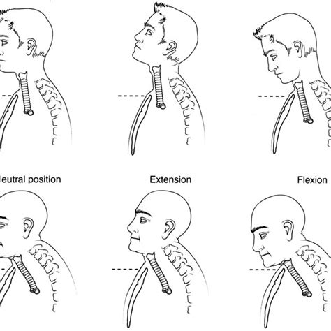 Mobility of the trachea with flexion and extension of the neck. | Download Scientific Diagram