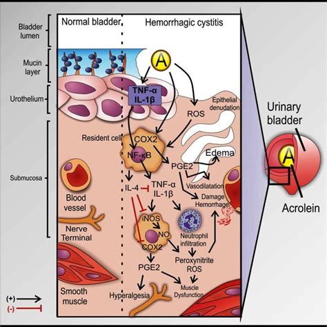 Proposed sequential phases of the development of hemorrhagic cystitis. | Download Scientific Diagram