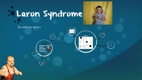 Laron Syndrome by anthony l on Prezi