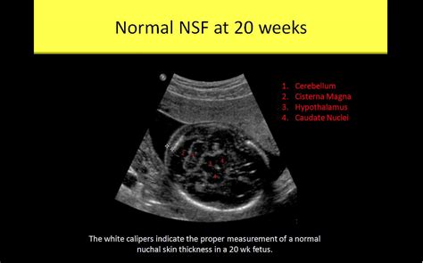 OB GYN Ultrasound Registry Review