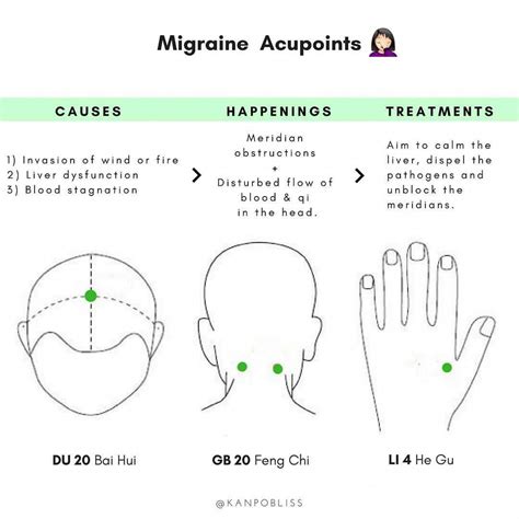 Tension Migraine Pressure Points at Michael Wilson blog