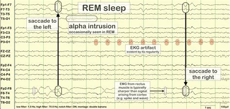 rapid eye movement (REM) sleep