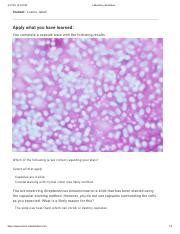 Learn How to Perform Capsule Staining in Microbiology Lab | Course Hero