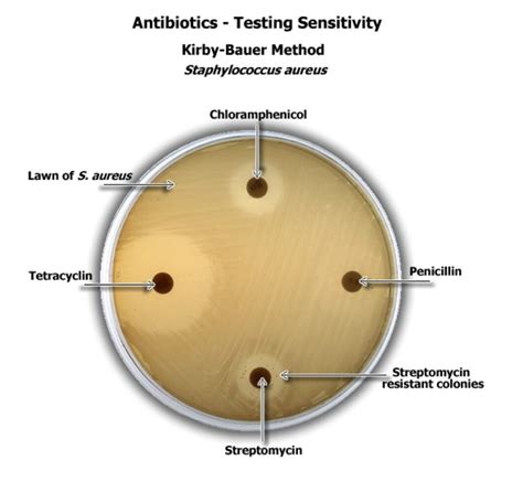 Kirby Baeur disc diffusion technique of antibiotic testing ...