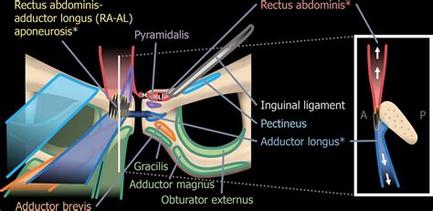 Imaging of the Pubic Symphysis: Anatomy and Pathologic Conditions ...