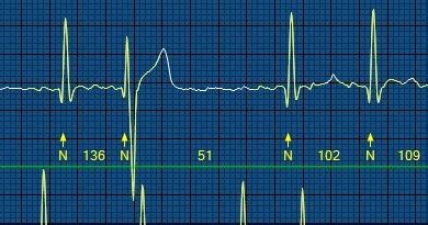 Andrew R. Houghton: What is the Ashman phenomenon?