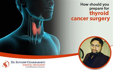 How Should You Prepare for Thyroid Cancer Surgery?