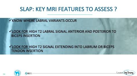 MRI Shoulder SLAP Tears 3 Things to look for - Radedasia