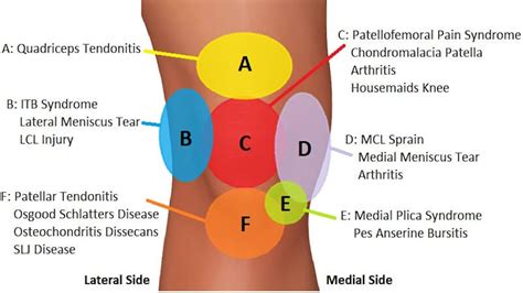 Knee Pain - Muscle Tone