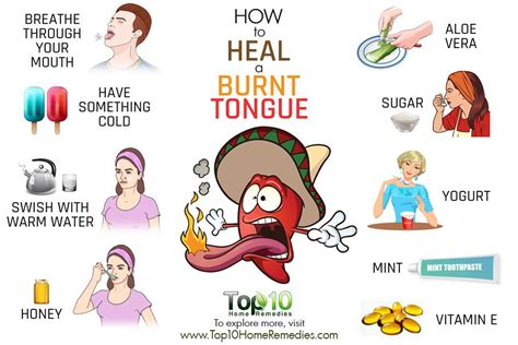 How to Heal a Burnt Tongue | Top 10 Home Remedies