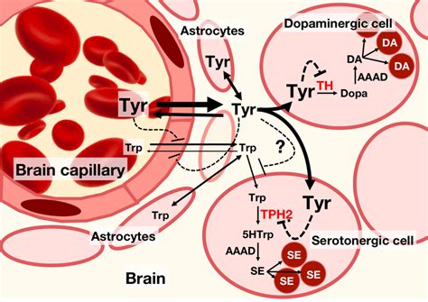 Tyrosinemia Type 1