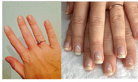Start To Repair Nails After Acrylics Today With These Useful Tips | Nail repair, Nails after ...
