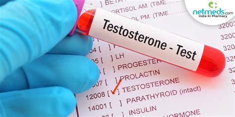 Testosterone Test: What Is It, Purpose, Procedure And Results