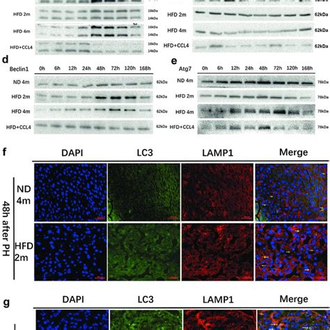 Autophagy was observed in the control group (ND4m), mild to moderately... | Download Scientific ...