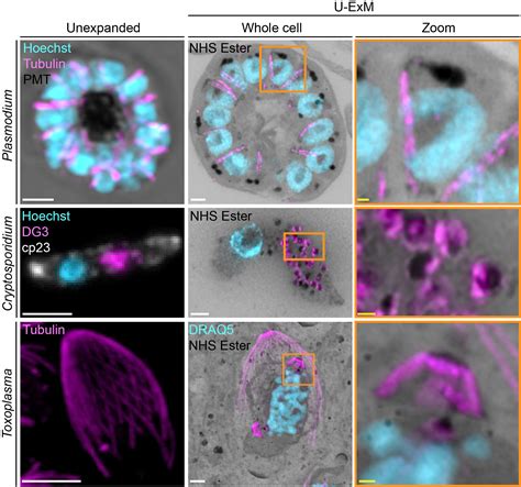 Expansion microscopy of apicomplexan parasites - Authorea