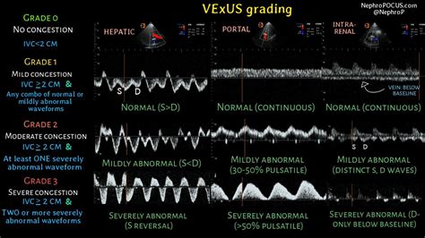 Discover and read the best of Twitter Threads about #vexus