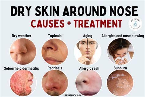 Dry and Peeling Skin Around Nose: 13 Causes & How to Treat it