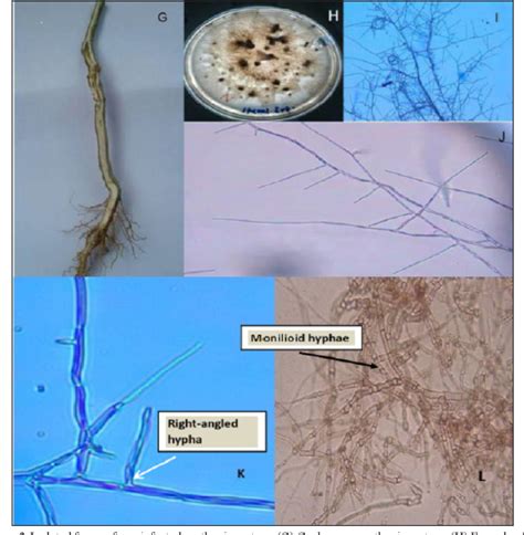 [PDF] First report of rhizoctonia solani kuhn. Isolated from parthenium weed (Parthenium ...