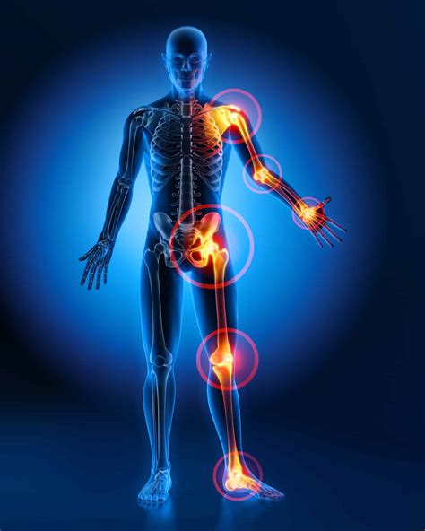 Joint Injections for Osteoarthritis: Precautions and Efficacy