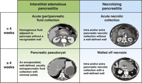 American Gastroenterological Association Clinical Practice Update ...