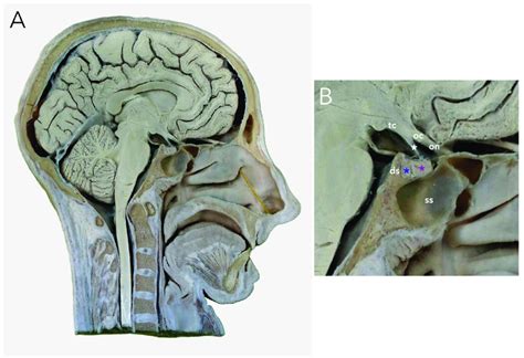 Pituitary gland on the sagittal cross-section of a human cadaver head.... | Download Scientific ...