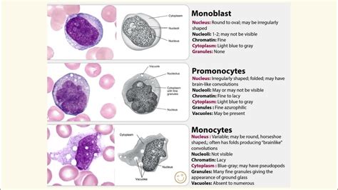 Medical Haematology - Monocyte maturation series (monoblast vs promonocyte vs monocyte) - YouTube