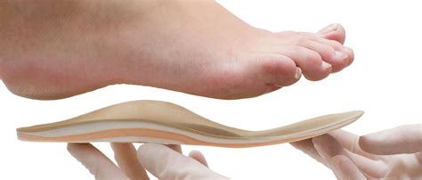 Pes Planus (Flat Feet) | On the Ball Orthotics, Barrie Ontario