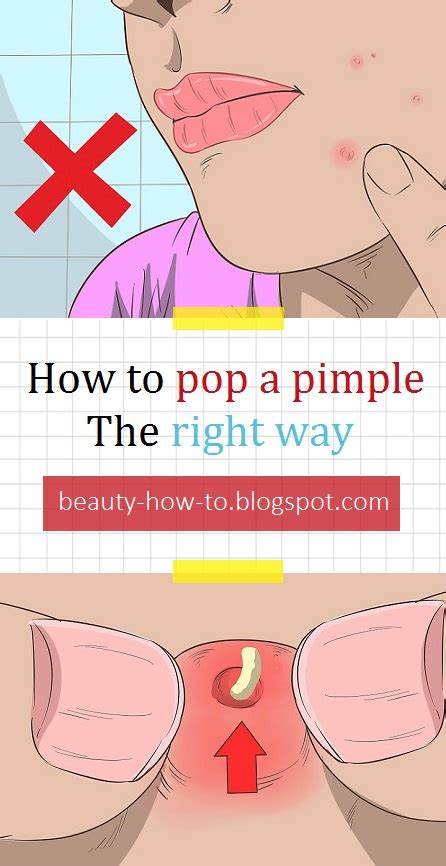 How to Pop a Pimple the Right Way - How To Beauty