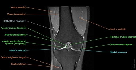 Knee Anatomy Mri