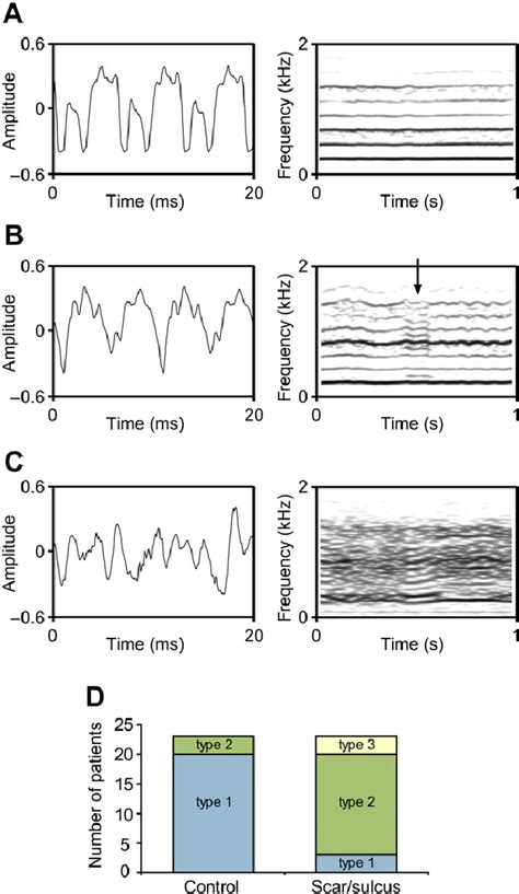 Representative waveforms and narrowband spectrograms obtained during ...