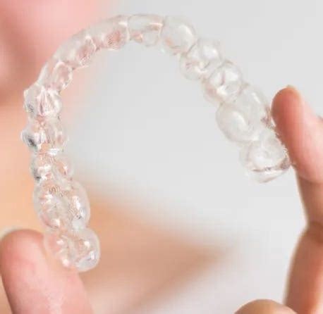 Byte Invisible Braces And Teeth Aligners Review Of January 2025 – Forbes Health