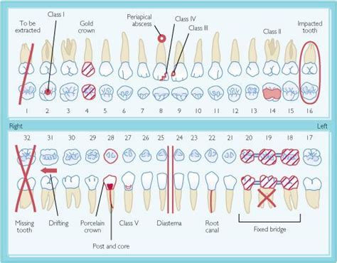 Pin on Dental humor