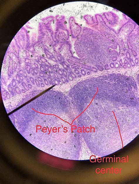 Peyer's Patch Histology.