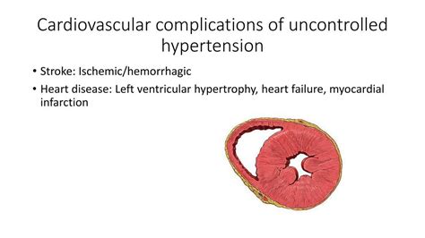 Blood Pressure Hypertension Orthostatics - ppt download