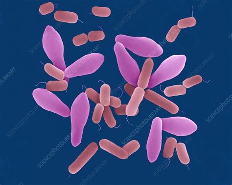 Clostridium perfringens, bacterium, SEM - Stock Image - C032/2632 ...