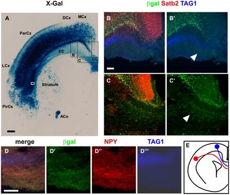 (A) X-Gal staining on 35-µm coronal sections of P0 AS021-lacZ animals... | Download Scientific ...