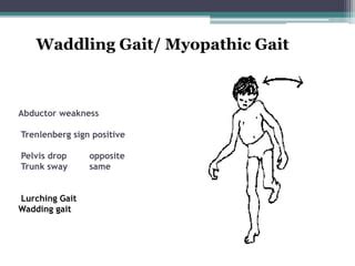 Gait abnormalities presentation | PPT