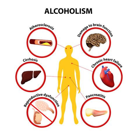 Learn the Facts on Alcohol and the Dangers of Addiction - Greater Waterbury Imaging Center