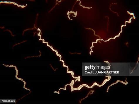 106 Microscopic Image Of Borrelia Burgdorferi Stock Photos, High-Res Pictures, and Images ...