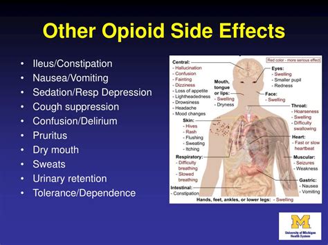 PPT - What’s New I n Acute Pain Management: Reducing Our Dependence O n Opioids PowerPoint ...