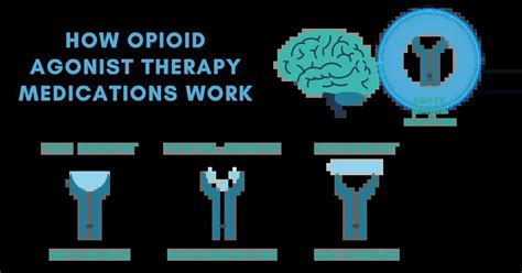 Opioid Agonist Therapy: What To Know - Asheville Detox Center