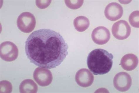 Normal White Blood Cells on a Smear | Medical Laboratories